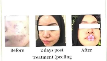 Hannan Medispa Seberang Jaya - Jln Baru