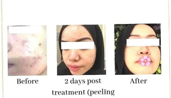 Hannan Medispa Seberang Jaya - Jln Baru